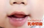 子どもの虫歯予防のために、保育士にできる工夫や取り組みって？